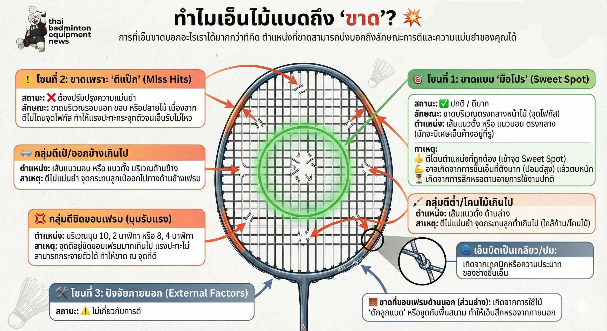 เอ็นไม้แบดขาดบอกอะไรได้บ้าง??
